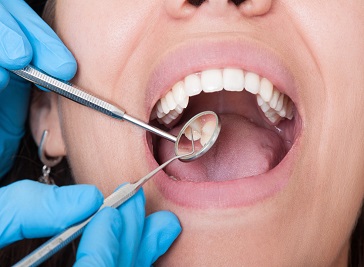 Accent Dental Care in Calgary